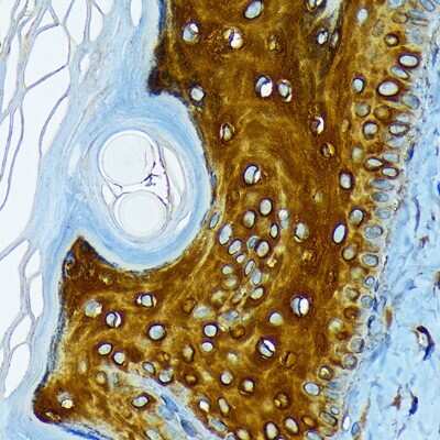 Immunohistochemistry-Paraffin: Cytokeratin 1 Antibody (10W8J6) [NBP3-16883]