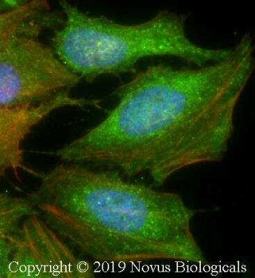 Immunocytochemistry/ Immunofluorescence: Cytokeratin 1 Antibody (3C10F7) - BSA Free [NB110-89450]