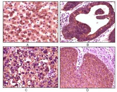 Immunohistochemistry-Paraffin: Cytokeratin 1 Antibody (3C10F7) - BSA Free [NB110-89450]
