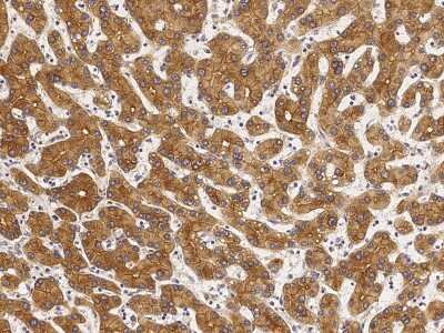 Immunohistochemistry-Paraffin: Cytokeratin 1 Antibody [NBP2-98734]