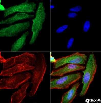 Immunocytochemistry/ Immunofluorescence: Cytokeratin 1 Antibody (LHK1) - Azide and BSA Free [NBP2-80688]