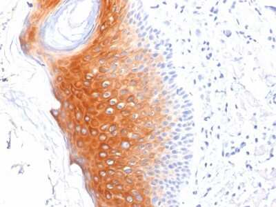 Immunohistochemistry-Paraffin: Cytokeratin 1 Antibody (LHK1) [NBP3-07775]