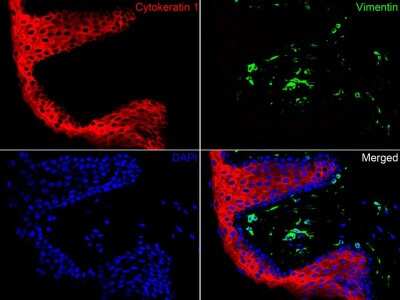 Immunohistochemistry-Paraffin: Cytokeratin 1 Antibody (SN72-08) [NBP2-67681]