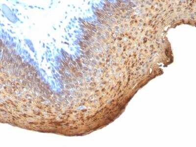 Immunohistochemistry-Paraffin: Cytokeratin 10/13 Antibody (DE-K13) - IHC-Prediluted [NBP2-48185]