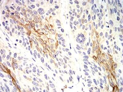 Immunohistochemistry: Cytokeratin 10 Antibody (1C3D9) - BSA Free [NBP2-61737]