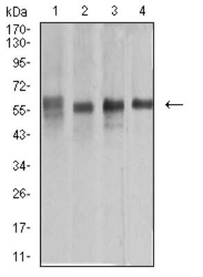 Western Blot: Cytokeratin 10 Antibody (1C3D9)BSA Free [NBP2-61737]