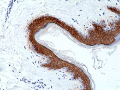 Immunohistochemistry-Paraffin: Cytokeratin 10 Antibody (RM386) [NBP2-89092]