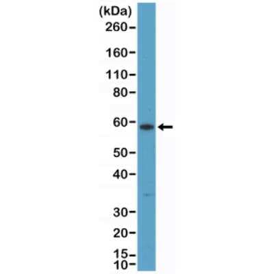Western Blot: Cytokeratin 10 Antibody (RM386) [NBP2-89092]