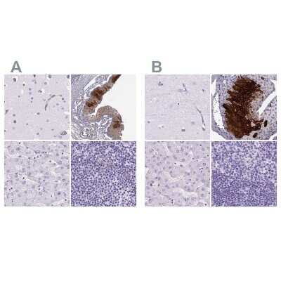 Immunohistochemistry-Paraffin: Cytokeratin 12 Antibody [NBP2-58100]