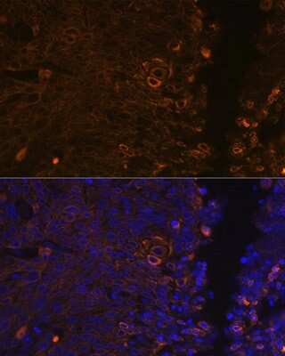Immunocytochemistry/ Immunofluorescence: Cytokeratin 13 Antibody (5M6B10) [NBP3-15261]