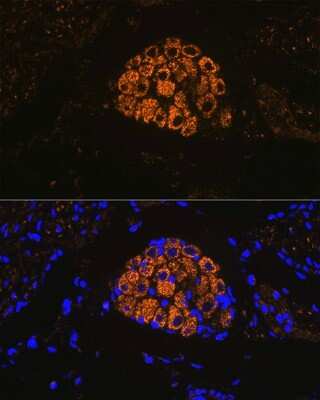 Immunohistochemistry: Cytokeratin 13 Antibody (5M6B10) [NBP3-15261]