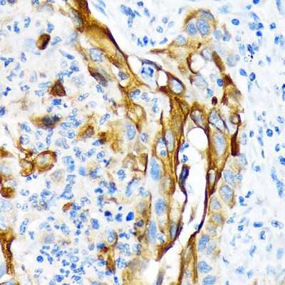 Immunohistochemistry-Paraffin: Cytokeratin 13 Antibody (5M6B10) [NBP3-15261]