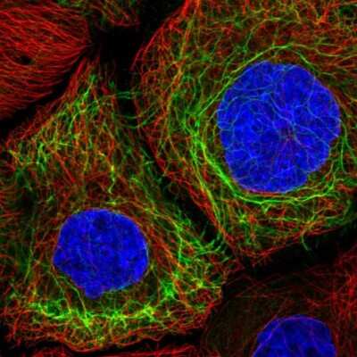 Immunocytochemistry/ Immunofluorescence: Cytokeratin 13 Antibody [NBP2-38166]