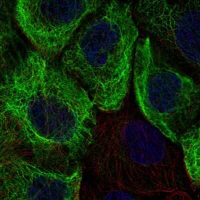 Immunocytochemistry/ Immunofluorescence: Cytokeratin 13 Antibody [NBP2-68890]