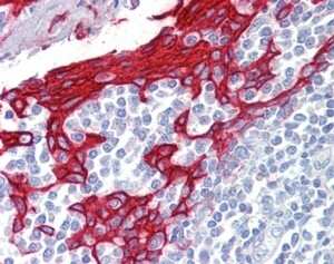Immunohistochemistry-Paraffin: Cytokeratin 13 Antibody [NBP1-06047]