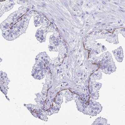 Immunohistochemistry-Paraffin: Cytokeratin 13 Antibody [NBP2-38166]