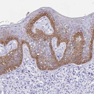 Immunohistochemistry-Paraffin: Cytokeratin 13 Antibody [NBP2-38166]