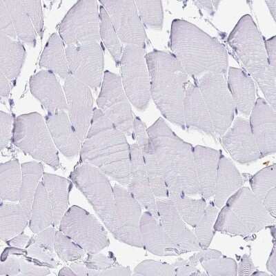 Immunohistochemistry-Paraffin: Cytokeratin 13 Antibody [NBP2-38166]