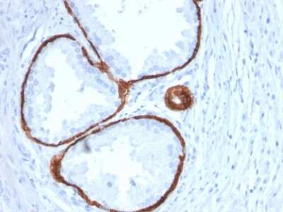 Immunohistochemistry-Paraffin: Cytokeratin 14 Antibody (KRT14/2375) - Azide and BSA Free [NBP3-08531]