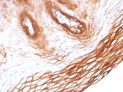 Immunohistochemistry-Paraffin: Cytokeratin 14 Antibody (KRT14/2375) [NBP3-07600]