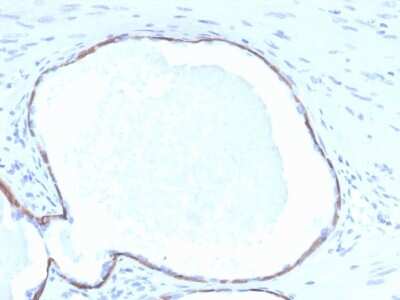Immunohistochemistry-Paraffin: Cytokeratin 14 Antibody (KRT14/4132) - Azide and BSA Free [NBP3-08289]