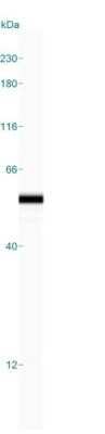Simple Western: Cytokeratin 14 Antibody (LL002)Azide and BSA Free [NBP2-34675]