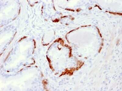 Immunohistochemistry-Paraffin: Cytokeratin 14 Antibody (LL002) - IHC-Prediluted [NBP2-45029]