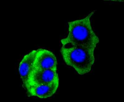 Immunocytochemistry/ Immunofluorescence: Cytokeratin 14 Antibody (SC65-06) [NBP2-67585]