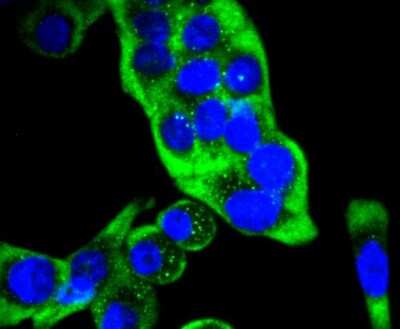Immunocytochemistry/ Immunofluorescence: Cytokeratin 14 Antibody (SC65-06) [NBP2-67585]