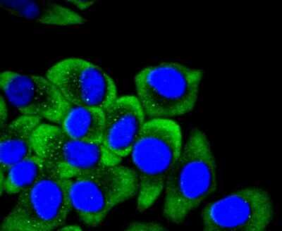 Immunocytochemistry/ Immunofluorescence: Cytokeratin 14 Antibody (SC65-06) [NBP2-67585]