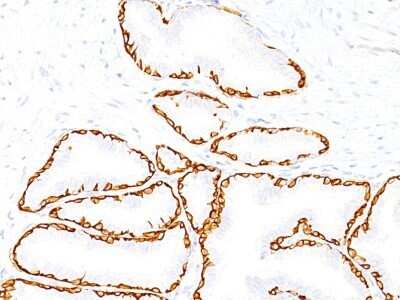 Immunohistochemistry-Paraffin: Cytokeratin 14 Antibody (SPM263) - Azide and BSA Free [NBP2-34403]