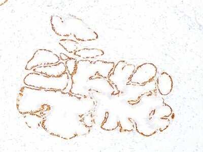 Immunohistochemistry-Paraffin: Cytokeratin 14 Antibody (SPM263) - Azide and BSA Free [NBP2-34403]