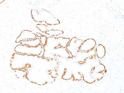 Immunohistochemistry-Paraffin: Cytokeratin 14 Antibody (SPM263) [NBP2-34355]