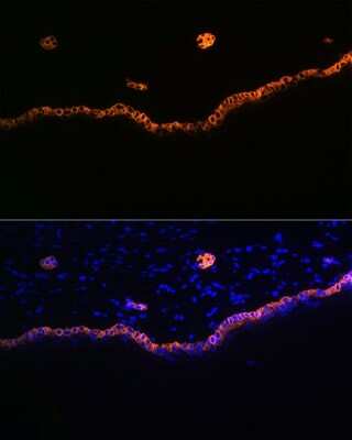 Immunohistochemistry: Cytokeratin 15 Antibody (9F9F0) [NBP3-16492]