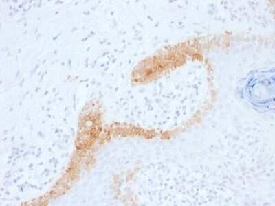 Immunohistochemistry-Paraffin: Cytokeratin 15 Antibody (KRT15/1699) [NBP2-53307]