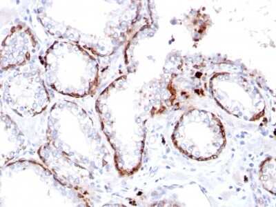 Immunohistochemistry-Paraffin: Cytokeratin 15 Antibody (KRT15/2103R) [NBP3-07621]