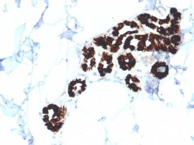 Immunohistochemistry-Paraffin: Cytokeratin 15 Antibody (KRT15/2554) [NBP3-07612]