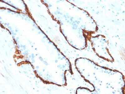 Immunohistochemistry-Paraffin: Cytokeratin 15 Antibody (KRT15/2554) - Azide and BSA Free [NBP3-08562]