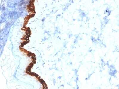 Immunohistochemistry-Paraffin: Cytokeratin 15 Antibody (KRT15/2554) - Azide and BSA Free [NBP3-08562]