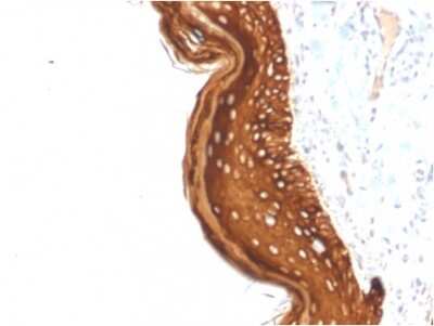 Immunohistochemistry-Paraffin: Cytokeratin 15 Antibody (KRT15/2957) - Azide and BSA Free [NBP3-08478]