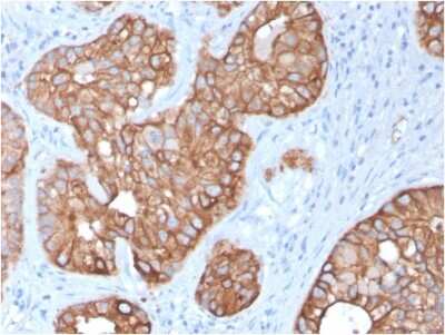 Immunohistochemistry-Paraffin: Cytokeratin 15 Antibody (KRT15/2957) - Azide and BSA Free [NBP3-08478]