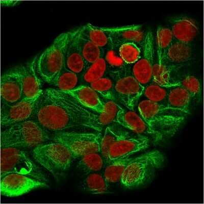 Immunocytochemistry/ Immunofluorescence: Cytokeratin 15 Antibody (KRT15/2957) [NBP3-07613]