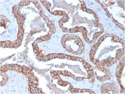 Immunohistochemistry-Paraffin: Cytokeratin 15 Antibody (KRT15/2957) [NBP3-07613]