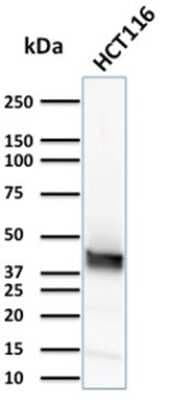 Western Blot: Cytokeratin 15 Antibody (KRT15/2957) [NBP3-07613]