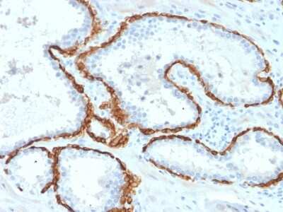 Immunohistochemistry-Paraffin: Cytokeratin 15 Antibody (KRT15/2958) [NBP3-07614]