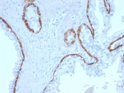 Immunohistochemistry-Paraffin: Cytokeratin 15 Antibody (KRT15/2958) - Azide and BSA Free [NBP3-08569]