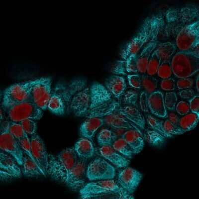 Immunocytochemistry/ Immunofluorescence: Cytokeratin 15 Antibody (KRT15/2959) [NBP3-07620]