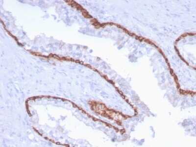 Immunohistochemistry-Paraffin: Cytokeratin 15 Antibody (KRT15/2959) [NBP3-07620]