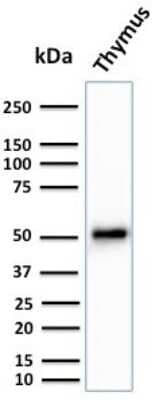 Western Blot: Cytokeratin 15 Antibody (KRT15/2959) [NBP3-07620]