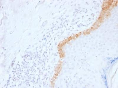 Immunohistochemistry-Paraffin: Cytokeratin 15 Antibody (LHK15) [NBP2-53308]